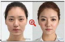 搞笑整形图片,搞笑整形图片大盘点